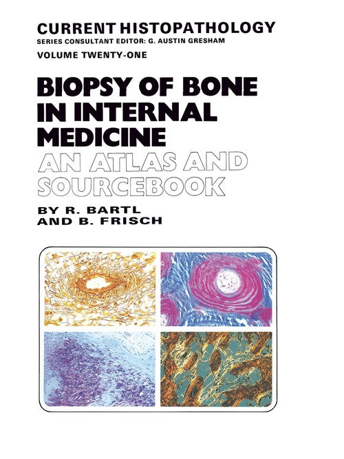 Biopsy of Bone in Internal Medicine: An Atlas and Sourcebook by Reiner Bartl | ISBN-13 9789401049856 PDF